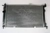 AUTOMEGA 3013000148 Radiator, engine cooling